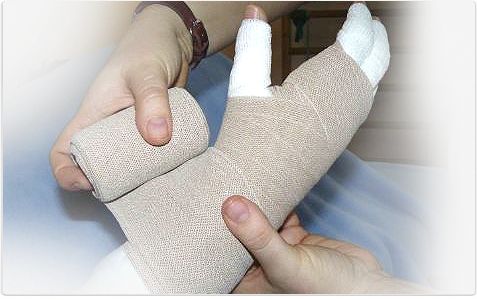 Kompressionsbandagierung